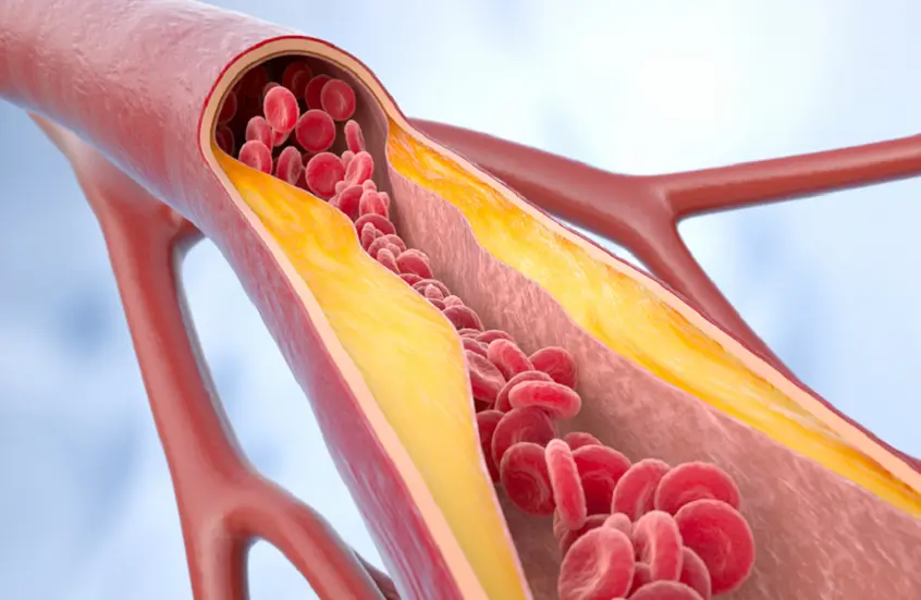 نوع من الدهون في الجسم يساعد على ضبط ضغط الدم